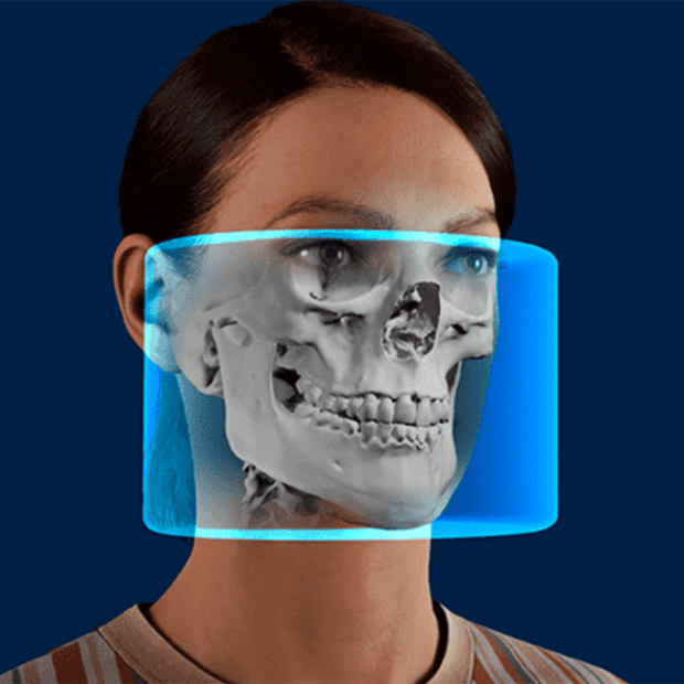 Nouveau FOV Nouveau FOV